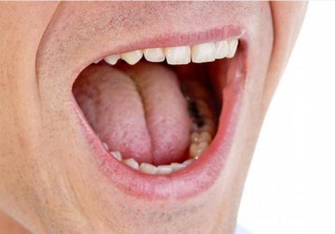 بماذا يشير جفاف الفم عند الاستيقاظ؟