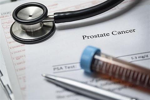 اكتشاف علاج جديد لمرضى سرطان البروستاتا