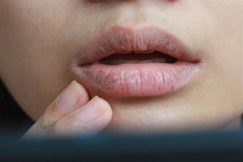 جفاف الفم في الصباح- هل يكون علامة على الإصابة