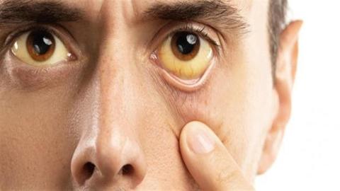 5 علامات في عينيك تشير لإصابتك بأمراض خطيرة