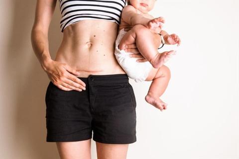 هكذا تؤثر الولادة القيصرية على الرضاعة