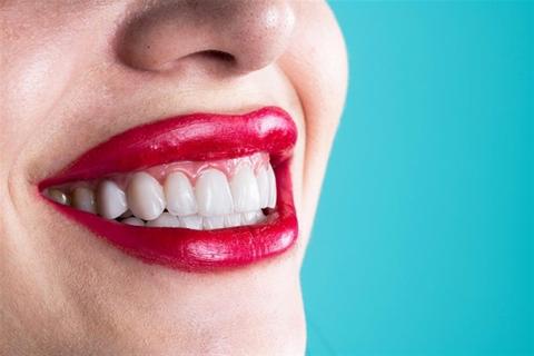 سافر أكثر وابتسم بإشراق- مزايا العلاج في عيادة أسنان بتركيا