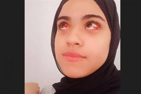بقع حمراء في العين- إليك التشخيص الطبي لحالة إسراء أحمد
